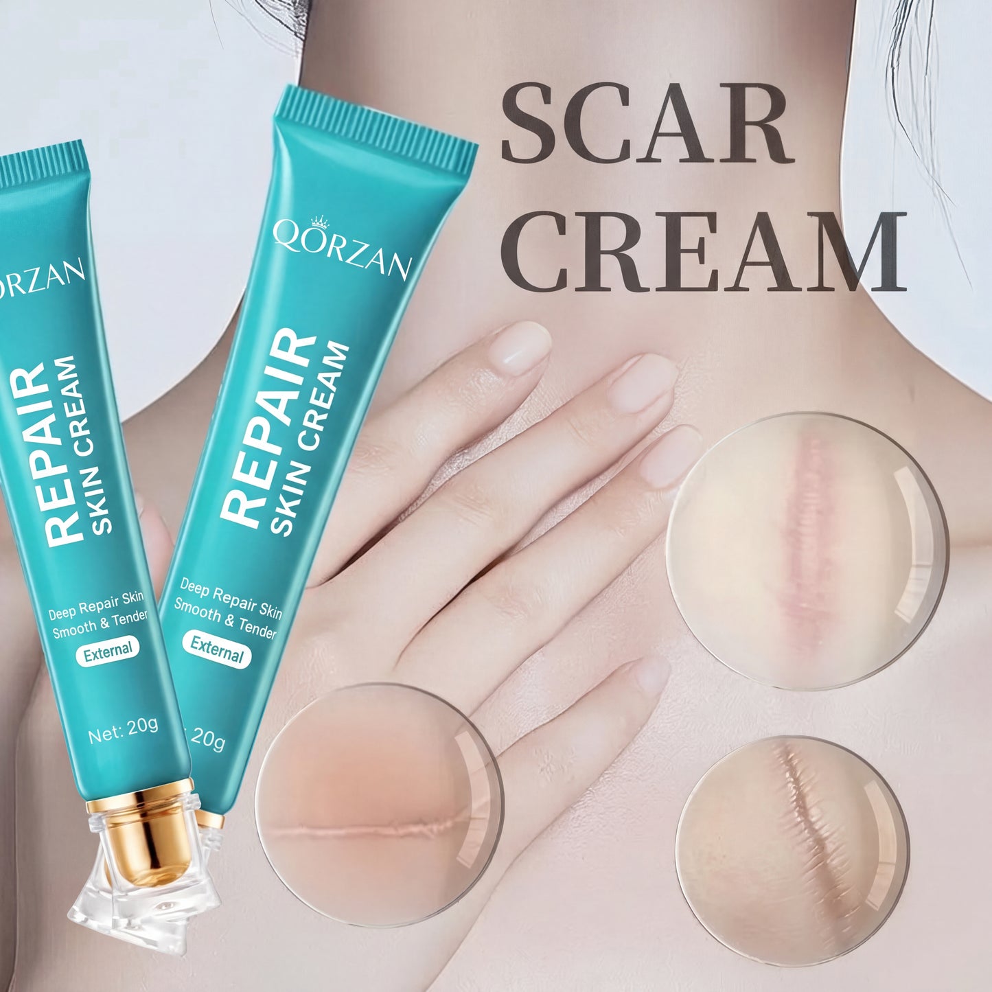 Qorzan Repair Scar Cream for Daily Scar Care