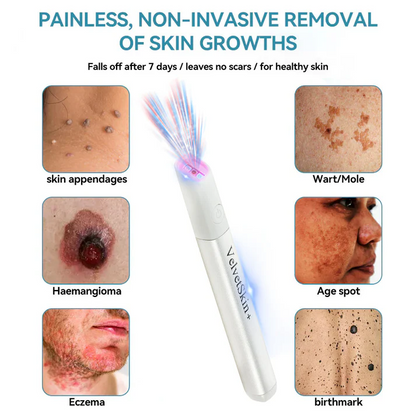 VelvetSkin+ All-in-One CO2Laser Eraser PenRemoves Moles, Warts,Skin Flaws &Pigmentation