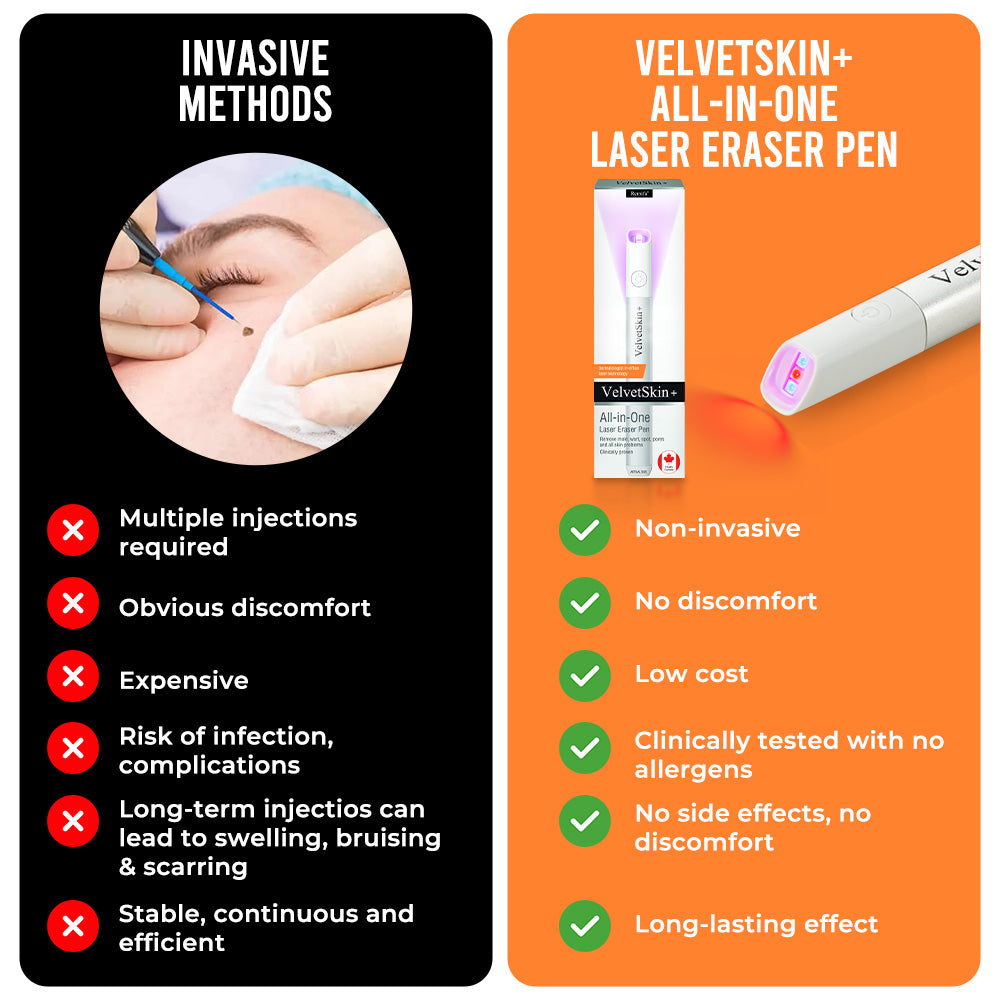 VelvetSkin+ All-in-One CO2Laser Eraser PenRemoves Moles, Warts,Skin Flaws &Pigmentation