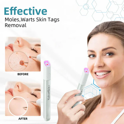 VelvetSkin+ All-in-One CO2Laser Eraser PenRemoves Moles, Warts,Skin Flaws &Pigmentation