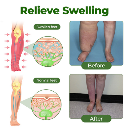 🔥2026🔥Most Popular-Timilk® Professional Leg Circulation Cream