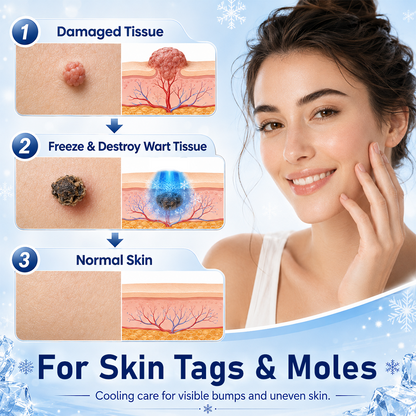 Timlk® CryoClear Pro Bump Renewal Spray