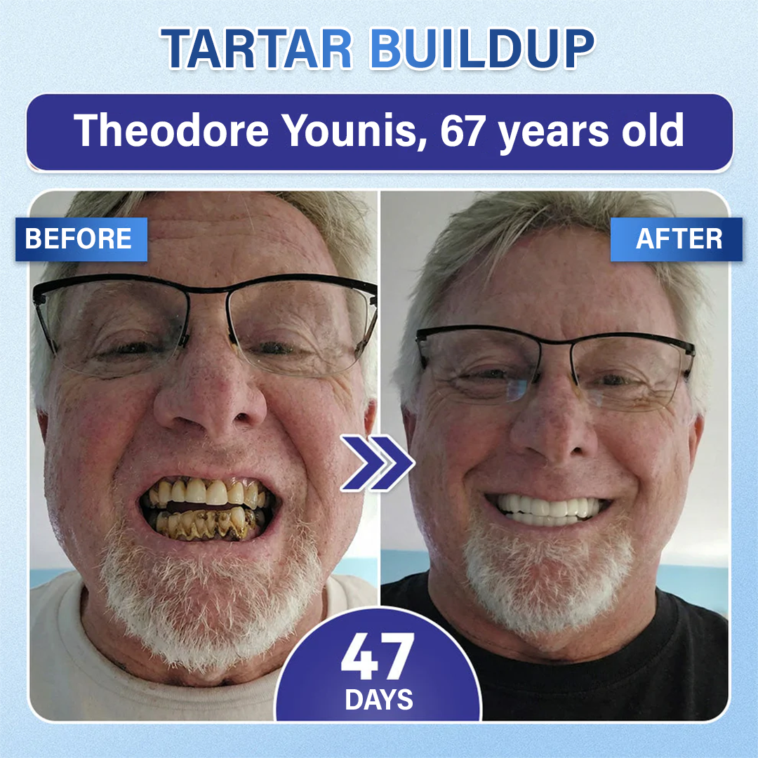 Your Smile🦷Tooth & Gum Repair Fast-Dissolving Microneedle Patch✨ (𝟓-𝐢𝐧-𝟏 💎 𝐑𝐞𝐛𝐮𝐢𝐥𝐝 𝐄𝐧𝐚𝐦𝐞𝐥 & 𝐃𝐞𝐧𝐭𝐢𝐧 • 𝐒𝐭𝐫𝐞𝐧𝐠𝐭𝐡𝐞𝐧 𝐆𝐮𝐦𝐬 • 𝐄𝐫𝐚𝐝𝐢𝐜𝐚𝐭𝐞 𝐓𝐚𝐫𝐭𝐚𝐫 & 𝐎𝐝𝐨𝐫 • 𝐖𝐡𝐢𝐭𝐞𝐧𝐢𝐧𝐠 • 𝐒𝐭𝐨𝐩 𝐓𝐨𝐨𝐭𝐡 𝐒𝐞𝐧𝐬𝐢𝐭𝐢𝐯𝐢𝐭𝐲)