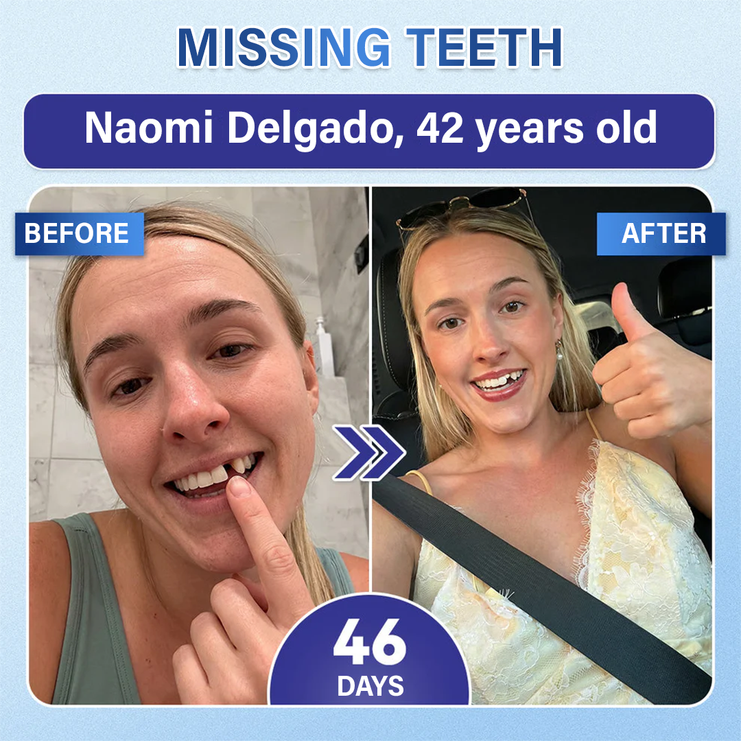 Your Smile🦷Tooth & Gum Repair Fast-Dissolving Microneedle Patch✨ (𝟓-𝐢𝐧-𝟏 💎 𝐑𝐞𝐛𝐮𝐢𝐥𝐝 𝐄𝐧𝐚𝐦𝐞𝐥 & 𝐃𝐞𝐧𝐭𝐢𝐧 • 𝐒𝐭𝐫𝐞𝐧𝐠𝐭𝐡𝐞𝐧 𝐆𝐮𝐦𝐬 • 𝐄𝐫𝐚𝐝𝐢𝐜𝐚𝐭𝐞 𝐓𝐚𝐫𝐭𝐚𝐫 & 𝐎𝐝𝐨𝐫 • 𝐖𝐡𝐢𝐭𝐞𝐧𝐢𝐧𝐠 • 𝐒𝐭𝐨𝐩 𝐓𝐨𝐨𝐭𝐡 𝐒𝐞𝐧𝐬𝐢𝐭𝐢𝐯𝐢𝐭𝐲)