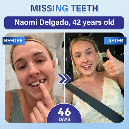 Your Smile🦷Tooth & Gum Repair Fast-Dissolving Microneedle Patch✨ (𝟓-𝐢𝐧-𝟏 💎 𝐑𝐞𝐛𝐮𝐢𝐥𝐝 𝐄𝐧𝐚𝐦𝐞𝐥 & 𝐃𝐞𝐧𝐭𝐢𝐧 • 𝐒𝐭𝐫𝐞𝐧𝐠𝐭𝐡𝐞𝐧 𝐆𝐮𝐦𝐬 • 𝐄𝐫𝐚𝐝𝐢𝐜𝐚𝐭𝐞 𝐓𝐚𝐫𝐭𝐚𝐫 & 𝐎𝐝𝐨𝐫 • 𝐖𝐡𝐢𝐭𝐞𝐧𝐢𝐧𝐠 • 𝐒𝐭𝐨𝐩 𝐓𝐨𝐨𝐭𝐡 𝐒𝐞𝐧𝐬𝐢𝐭𝐢𝐯𝐢𝐭𝐲)