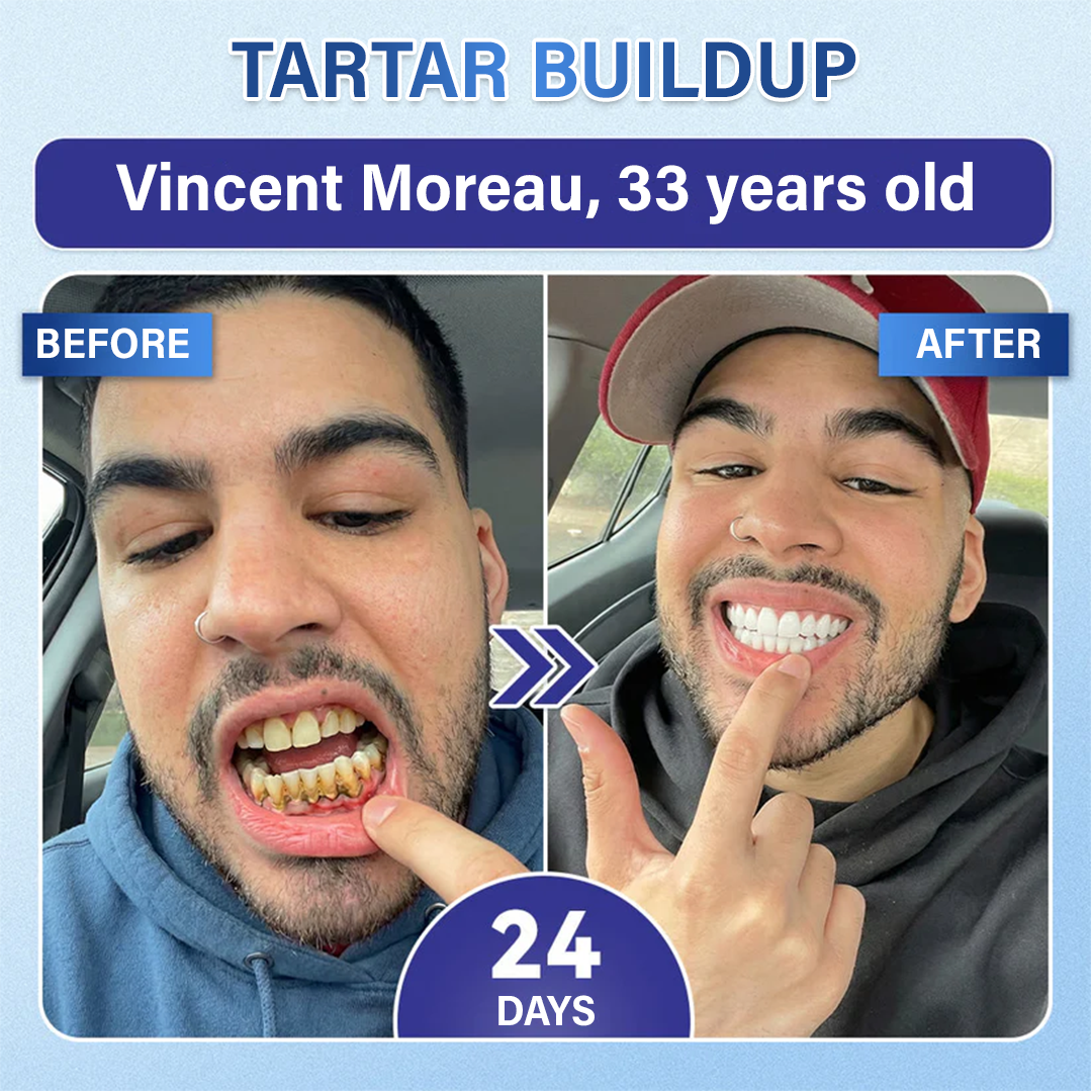 Your Smile🦷Tooth & Gum Repair Fast-Dissolving Microneedle Patch✨ (𝟓-𝐢𝐧-𝟏 💎 𝐑𝐞𝐛𝐮𝐢𝐥𝐝 𝐄𝐧𝐚𝐦𝐞𝐥 & 𝐃𝐞𝐧𝐭𝐢𝐧 • 𝐒𝐭𝐫𝐞𝐧𝐠𝐭𝐡𝐞𝐧 𝐆𝐮𝐦𝐬 • 𝐄𝐫𝐚𝐝𝐢𝐜𝐚𝐭𝐞 𝐓𝐚𝐫𝐭𝐚𝐫 & 𝐎𝐝𝐨𝐫 • 𝐖𝐡𝐢𝐭𝐞𝐧𝐢𝐧𝐠 • 𝐒𝐭𝐨𝐩 𝐓𝐨𝐨𝐭𝐡 𝐒𝐞𝐧𝐬𝐢𝐭𝐢𝐯𝐢𝐭𝐲)
