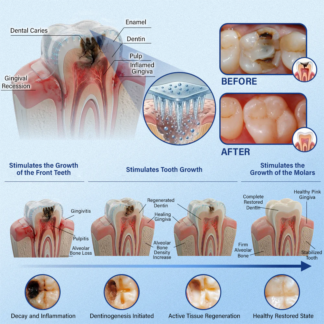 Your Smile🦷Tooth & Gum Repair Fast-Dissolving Microneedle Patch✨ (𝟓-𝐢𝐧-𝟏 💎 𝐑𝐞𝐛𝐮𝐢𝐥𝐝 𝐄𝐧𝐚𝐦𝐞𝐥 & 𝐃𝐞𝐧𝐭𝐢𝐧 • 𝐒𝐭𝐫𝐞𝐧𝐠𝐭𝐡𝐞𝐧 𝐆𝐮𝐦𝐬 • 𝐄𝐫𝐚𝐝𝐢𝐜𝐚𝐭𝐞 𝐓𝐚𝐫𝐭𝐚𝐫 & 𝐎𝐝𝐨𝐫 • 𝐖𝐡𝐢𝐭𝐞𝐧𝐢𝐧𝐠 • 𝐒𝐭𝐨𝐩 𝐓𝐨𝐨𝐭𝐡 𝐒𝐞𝐧𝐬𝐢𝐭𝐢𝐯𝐢𝐭𝐲)
