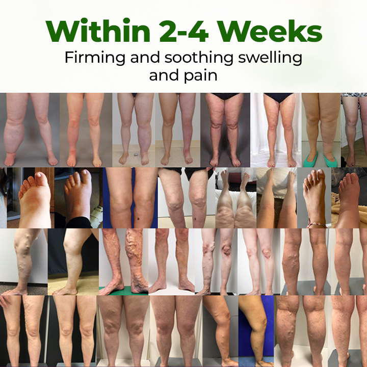 🔥2026🔥Most Popular-Timilk® Professional Leg Circulation Cream